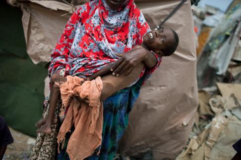 A woman holds a malnourished child at a makeshift camp in the Somali capital of Mogadishu.